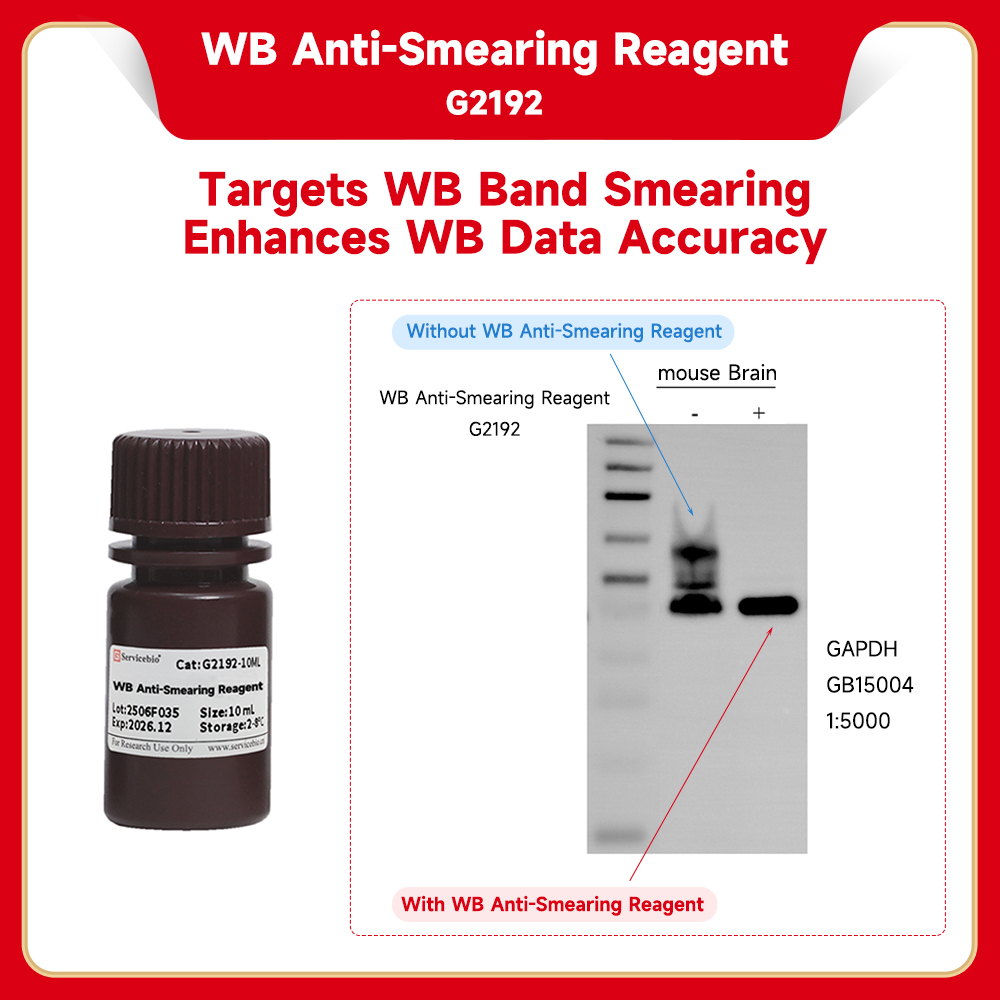 Servicebio WB Anti-Smearing Reagent - Servicebio | 웨스턴블롯 밴드 스미어링 억제 시약